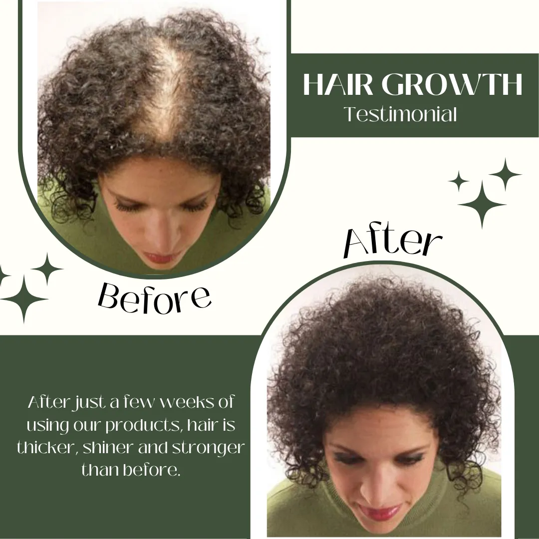 AS - Ultimate Ginger Hair Care Combo Pack - Herbishh