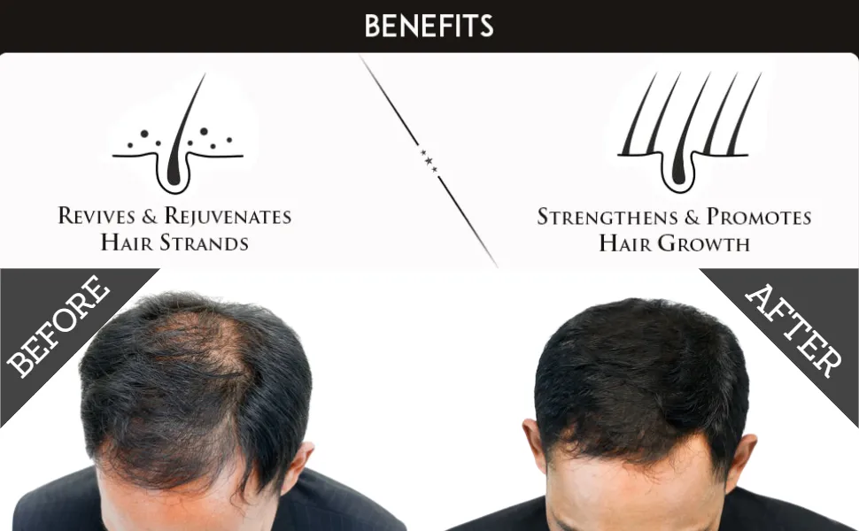 Hair Strengthening combo - Herbishh